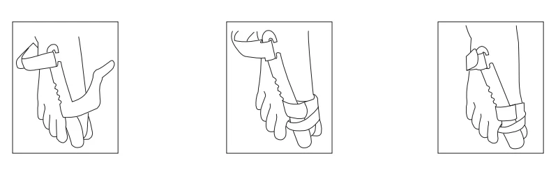 Instructions For Use Bunion Hallux Valgus Splint